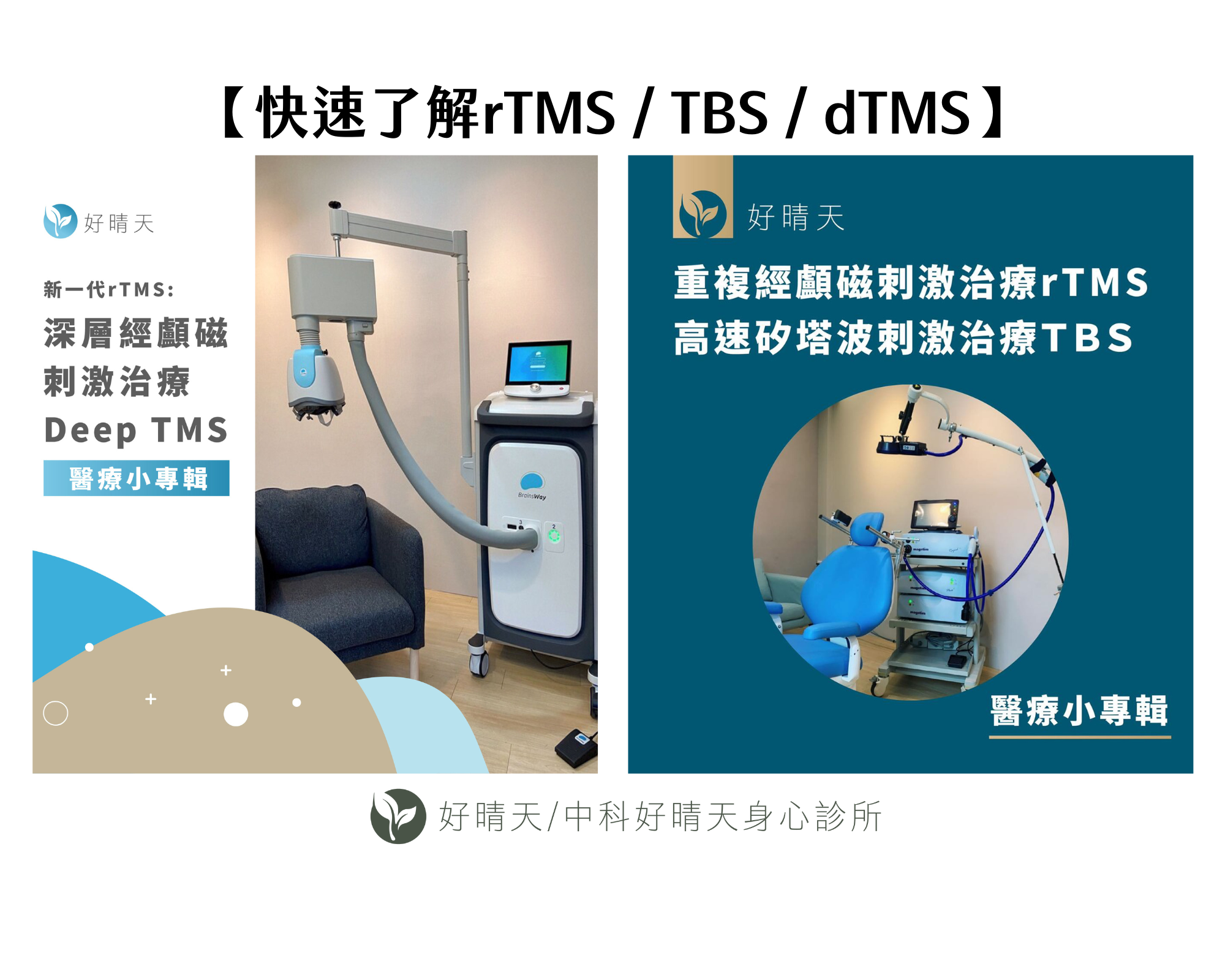 Read more about the article 【快速了解rTMS / TBS / dTMS】